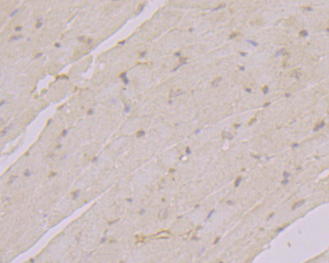 TGM2 Antibody in Immunohistochemistry (Paraffin) (IHC (P))