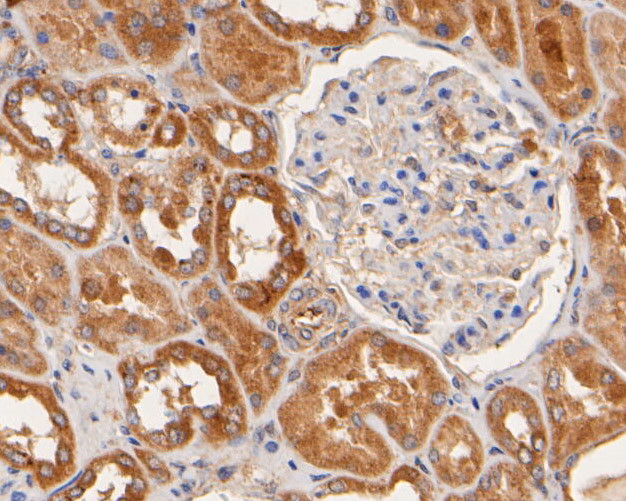 Nhe-1 Antibody in Immunohistochemistry (Paraffin) (IHC (P))