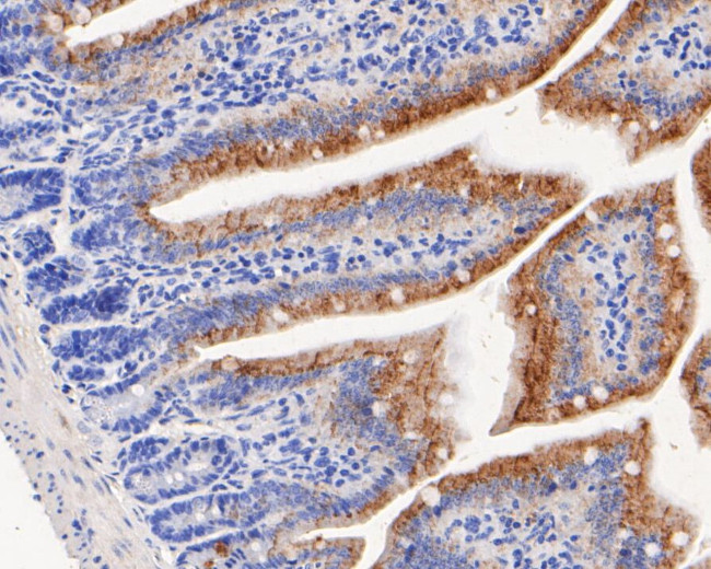 Nhe-1 Antibody in Immunohistochemistry (Paraffin) (IHC (P))