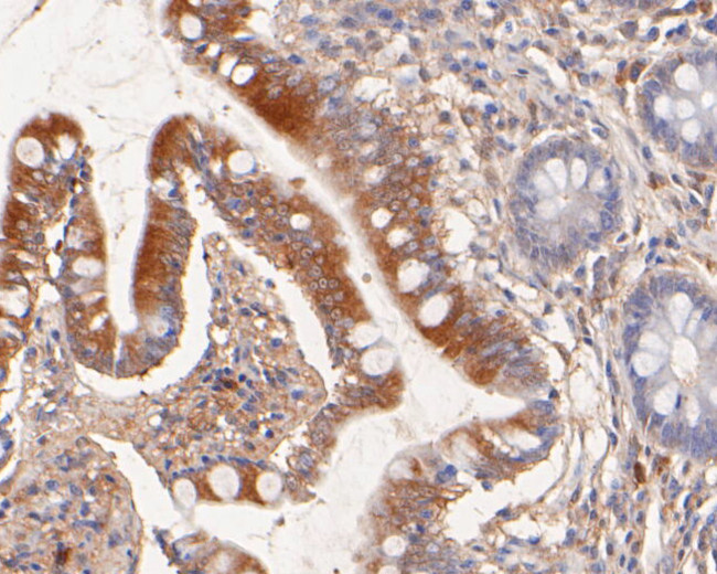 Nhe-1 Antibody in Immunohistochemistry (Paraffin) (IHC (P))