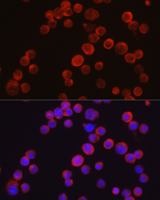 TEC Antibody in Immunocytochemistry (ICC/IF)