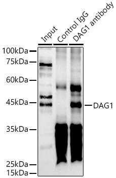 alpha Dystroglycan Antibody in Immunoprecipitation (IP)