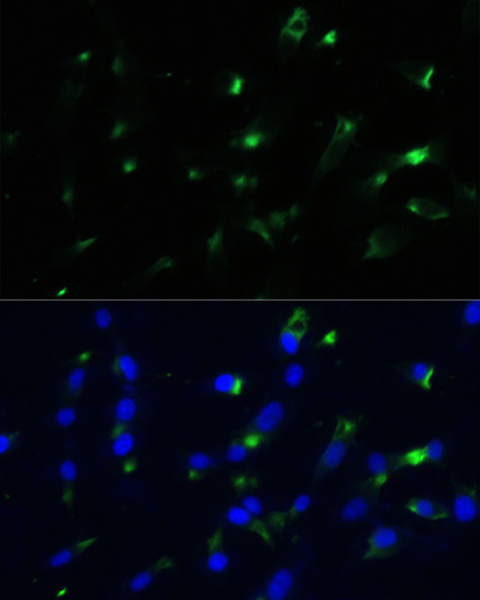 ENO1 Antibody in Immunocytochemistry (ICC/IF)