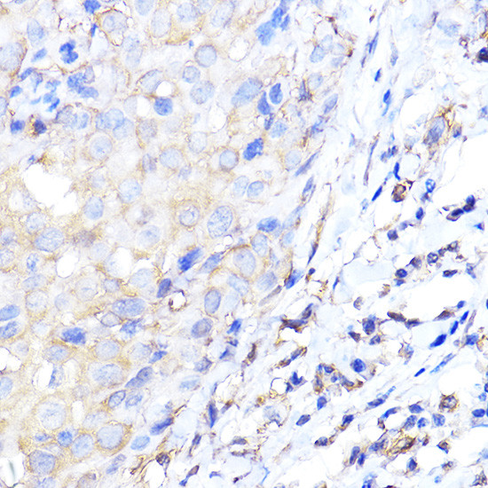 ENO1 Antibody in Immunohistochemistry (Paraffin) (IHC (P))