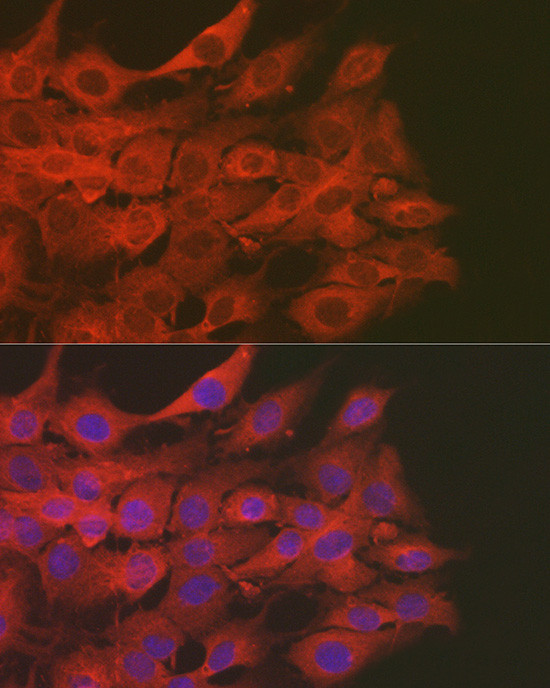 SOD2 (MnSOD) Antibody in Immunocytochemistry (ICC/IF)