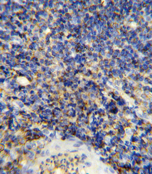 CD45 Antibody in Immunohistochemistry (Paraffin) (IHC (P))