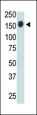 CD45 Antibody in Western Blot (WB)