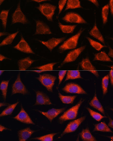 TMX2 Antibody in Immunocytochemistry (ICC/IF)