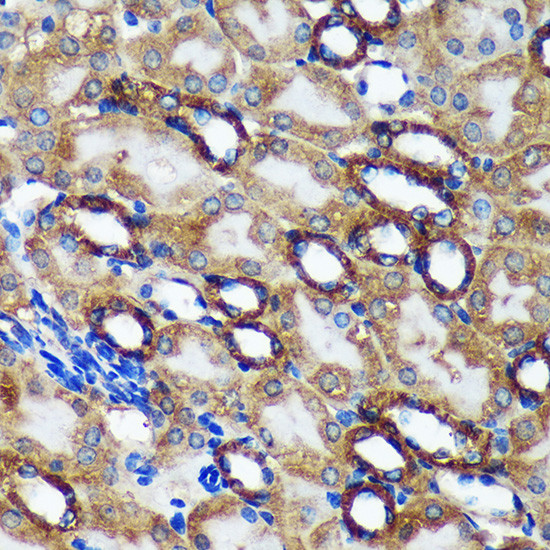 TMX2 Antibody in Immunohistochemistry (Paraffin) (IHC (P))