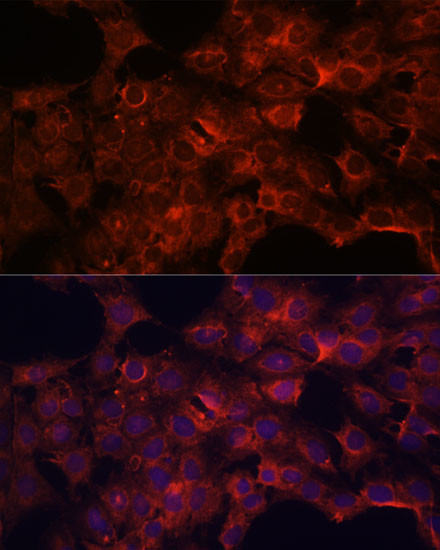 PDP2 Antibody in Immunocytochemistry (ICC/IF)