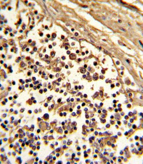 CD33 Antibody in Immunohistochemistry (Paraffin) (IHC (P))