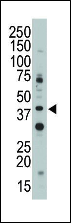 CD33 Antibody in Western Blot (WB)