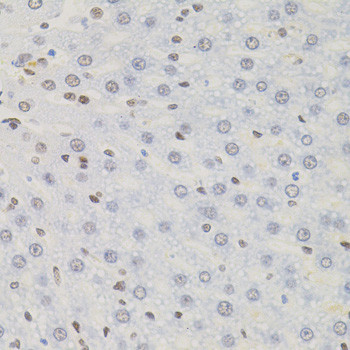 AKAP8 Antibody in Immunohistochemistry (Paraffin) (IHC (P))