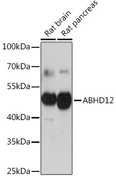 ABHD12 Antibody in Western Blot (WB)