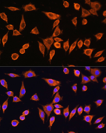 RPS28 Antibody in Immunocytochemistry (ICC/IF)