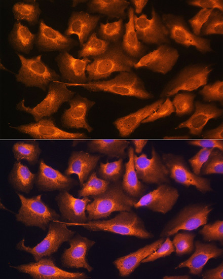 RPS28 Antibody in Immunocytochemistry (ICC/IF)