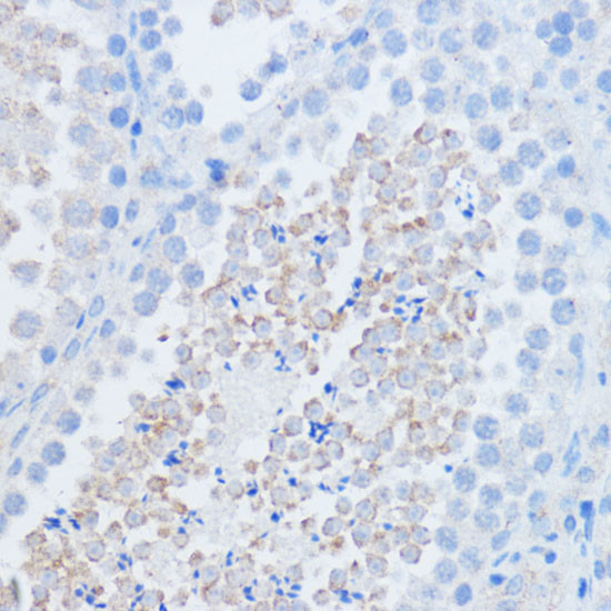 RALGDS Antibody in Immunohistochemistry (Paraffin) (IHC (P))
