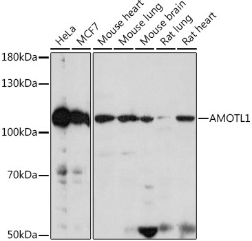 AMOTL1 Antibody in Western Blot (WB)