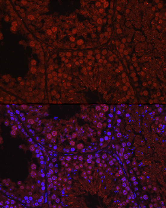 C1orf146 Antibody in Immunohistochemistry (Paraffin) (IHC (P))