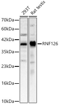 RNF126 Antibody in Western Blot (WB)