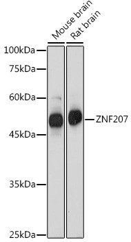 ZNF207 Antibody in Western Blot (WB)