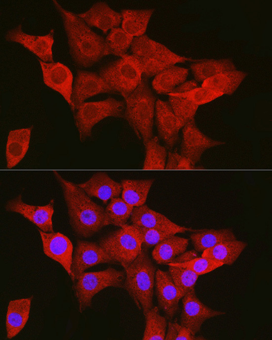 TTK Antibody in Immunocytochemistry (ICC/IF)