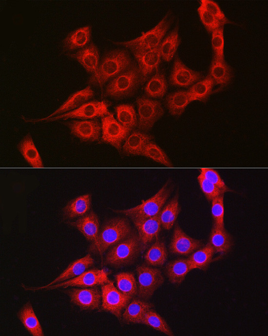 TTK Antibody in Immunocytochemistry (ICC/IF)