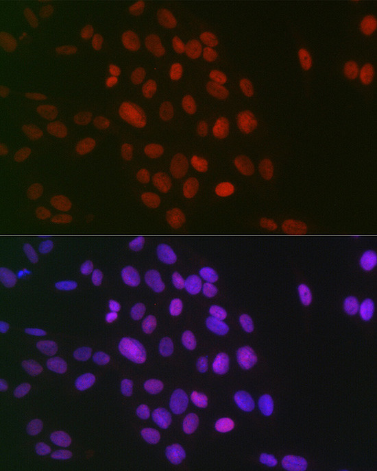 H3R26me2s Antibody in Immunocytochemistry (ICC/IF)