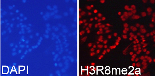 H3R8me2a Antibody in Immunocytochemistry (ICC/IF)