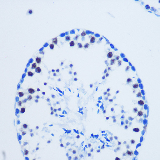 H3R8me2a Antibody in Immunohistochemistry (Paraffin) (IHC (P))