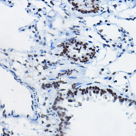 H4R3me1 Antibody in Immunohistochemistry (Paraffin) (IHC (P))