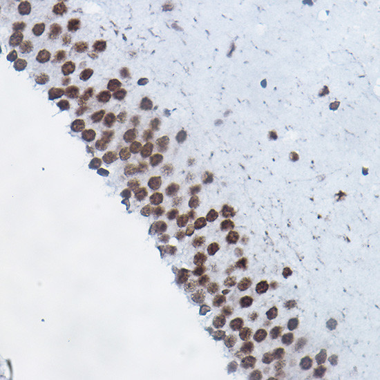 H4R3me1 Antibody in Immunohistochemistry (Paraffin) (IHC (P))