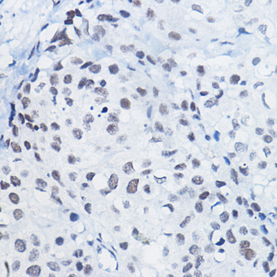 H4R3me1 Antibody in Immunohistochemistry (Paraffin) (IHC (P))