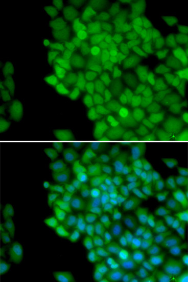 MAGE1 Antibody in Immunocytochemistry (ICC/IF)