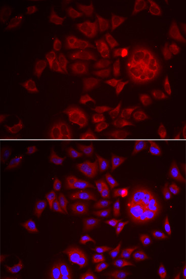 HAI-1 Antibody in Immunocytochemistry (ICC/IF)