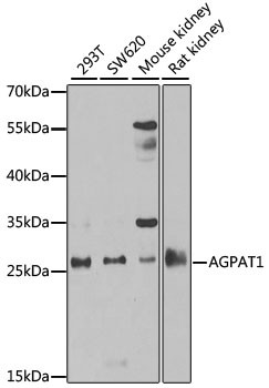 AGPAT1 Antibody in Western Blot (WB)