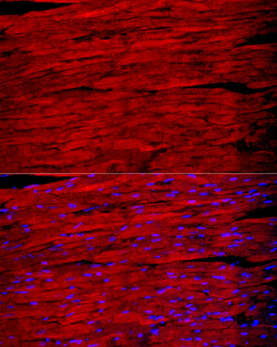 Myosin heavy chain 1 Antibody in Immunocytochemistry (ICC/IF)