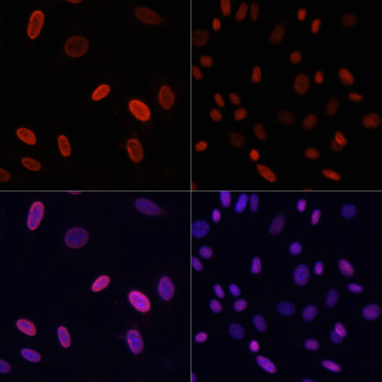 H3K9ac Antibody in Immunocytochemistry (ICC/IF)