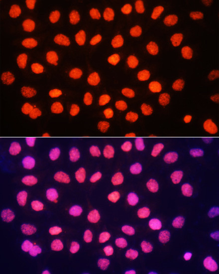 H3K64me3 Antibody in Immunocytochemistry (ICC/IF)