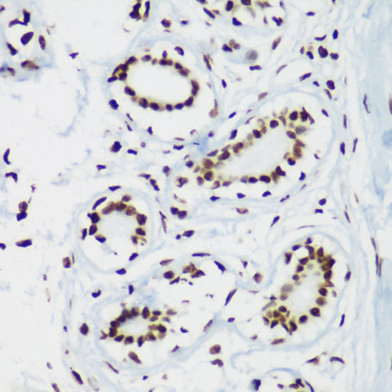 H3K64me3 Antibody in Immunohistochemistry (Paraffin) (IHC (P))