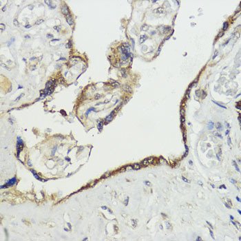 HACE1 Antibody in Immunohistochemistry (Paraffin) (IHC (P))