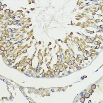 HACE1 Antibody in Immunohistochemistry (Paraffin) (IHC (P))