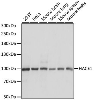 HACE1 Antibody in Western Blot (WB)