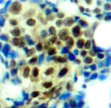 Phospho-ERK1 (Thr202, Tyr205) Antibody in Immunohistochemistry (Paraffin) (IHC (P))