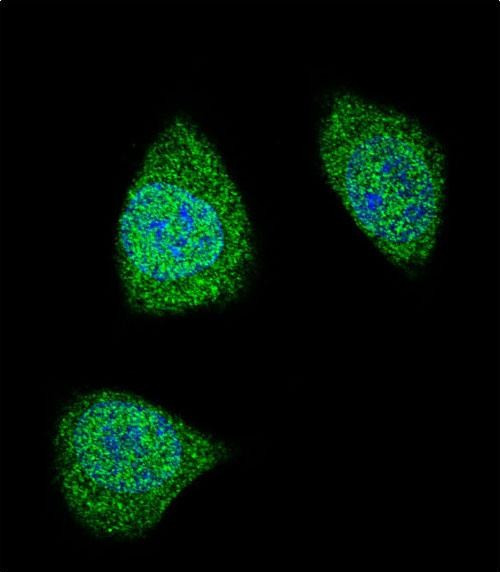 PDGF-B Antibody in Immunocytochemistry (ICC/IF)