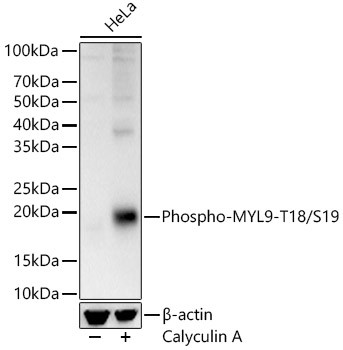 Phospho-MYL9 (Thr18, Ser19) Antibody in Western Blot (WB)