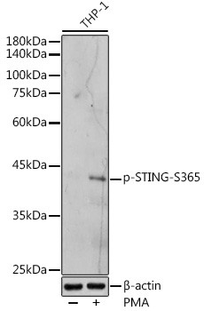 Phospho-STING (Ser365) Antibody in Western Blot (WB)