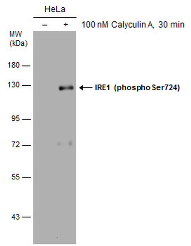 Phospho-IRE1 alpha (Ser724) Antibody in Western Blot (WB)