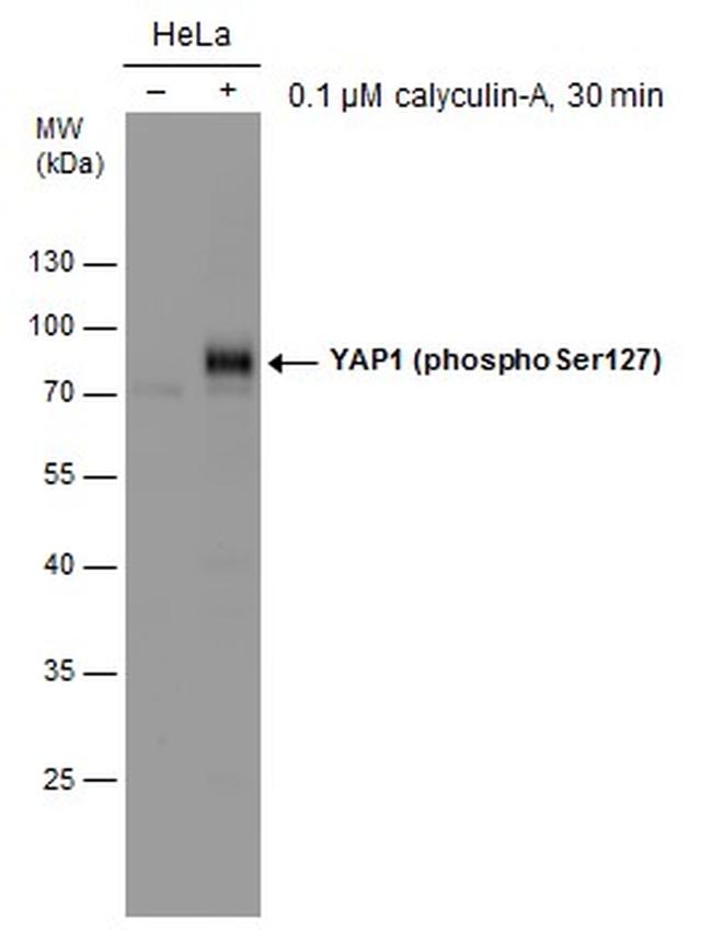 Phospho-YAP1 (Ser127) Antibody in Western Blot (WB)