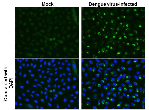 Dengue Virus Type 2 NS4A Antibody in Immunocytochemistry (ICC/IF)